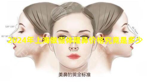 2024年上海做假体隆鼻价格究竟是多少