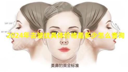 2024年去皱纹具体价格是多少怎么查询