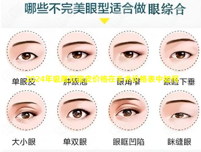 2024年吸雕双眼皮价格在手术价格表中如何