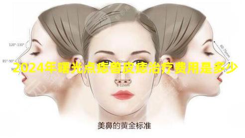 2024年曙光点痣兽皮痣治疗费用是多少