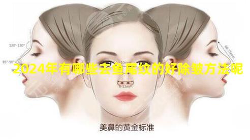 2024年有哪些去鱼尾纹的好除皱方法呢