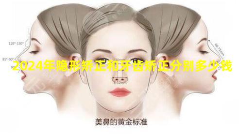 2024年隐形矫正和牙齿矫正分别多少钱