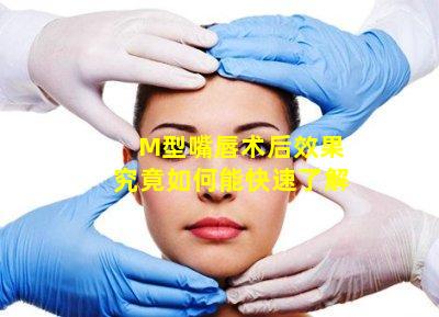 M型嘴唇术后效果究竟如何能快速了解
