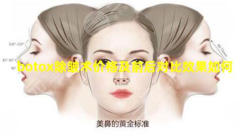 botox除皱术价格及前后对比效果如何