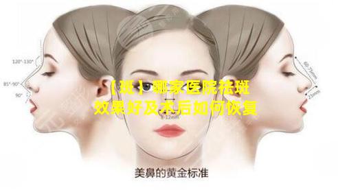 【斑】哪家医院祛斑效果好及术后如何恢复