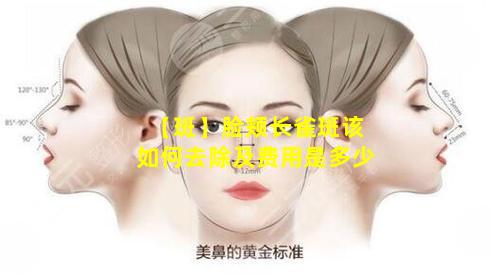 【斑】脸颊长雀斑该如何去除及费用是多少