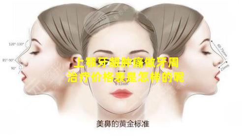 上颚牙龈肿痛做牙周治疗价格表是怎样的呢