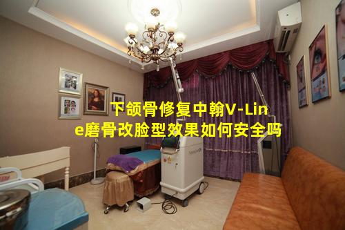 下颌骨修复中翰V-Line磨骨改脸型效果如何安全吗