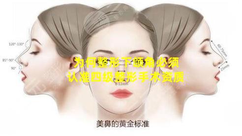 为何整形下颌角必须认准四级整形手术资质