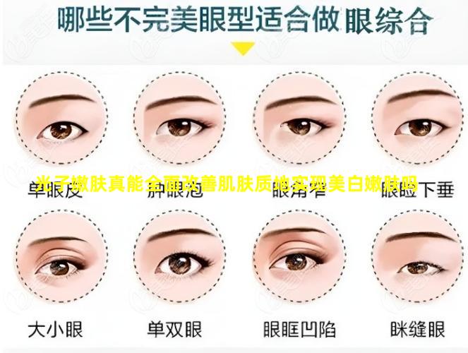 光子嫩肤真能全面改善肌肤质地实现美白嫩肤吗