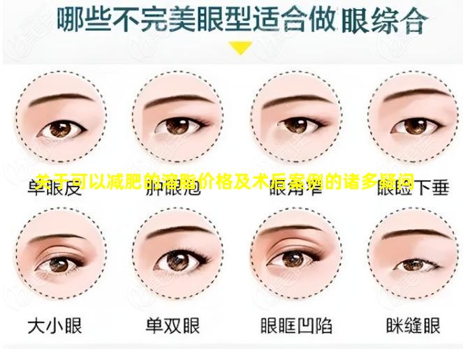 关于可以减肥的溶脂价格及术后案例的诸多疑问