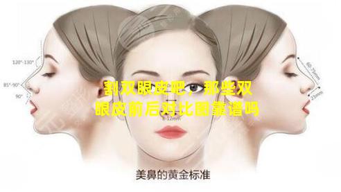 割双眼皮吧，那些双眼皮前后对比图靠谱吗