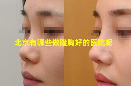 北京有哪些做隆胸好的医院呢