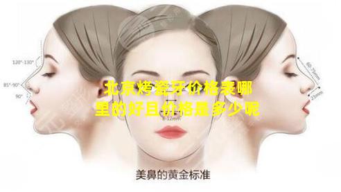 北京烤瓷牙价格表哪里的好且价格是多少呢