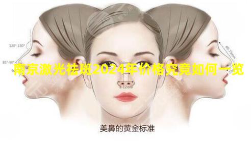 南京激光祛斑2024年价格究竟如何一览