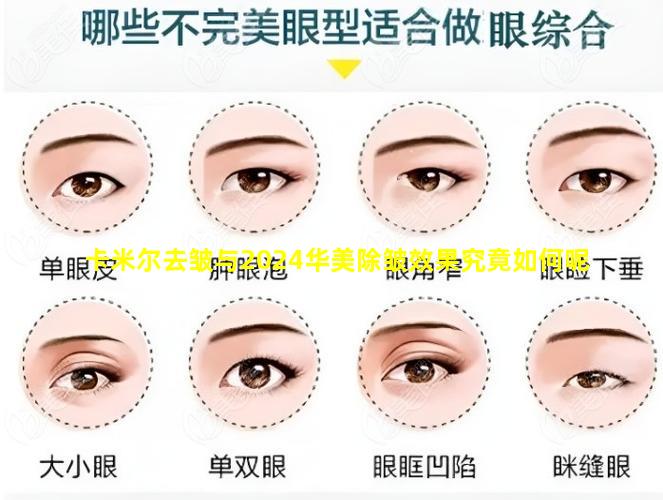 卡米尔去皱与2024华美除皱效果究竟如何呢