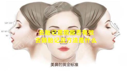 去胎记医院能否有效去除胎记及方法是什么