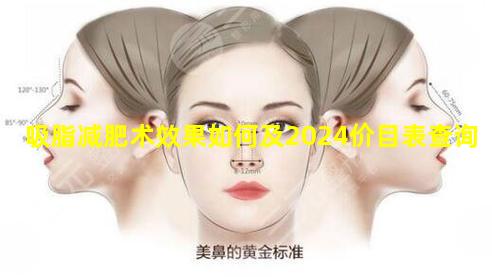 吸脂减肥术效果如何及2024价目表查询