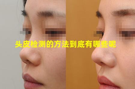头皮检测的方法到底有哪些呢