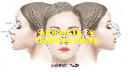 奇致推荐双眼皮，全切双眼皮类型该如何选