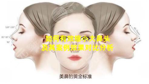 如何有效缩小大鼻头及其案例效果对比分析