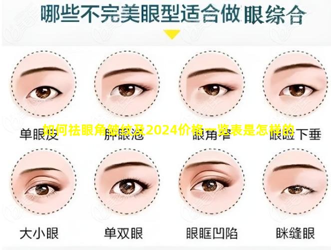 如何祛眼角皱纹及2024价格一览表是怎样的