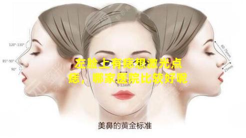 左脸上有痣想激光点痣，哪家医院比较好呢