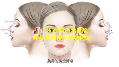 广州20年植发医院种头发效果究竟如何呢