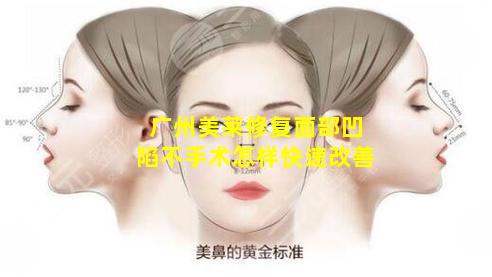 广州美莱修复面部凹陷不手术怎样快速改善