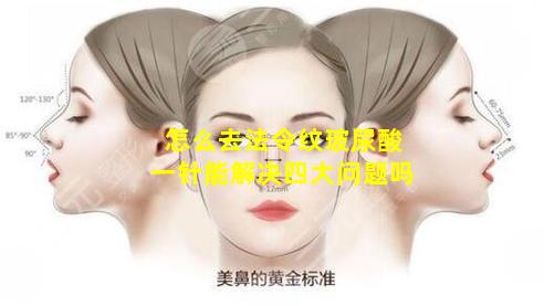 怎么去法令纹玻尿酸一针能解决四大问题吗