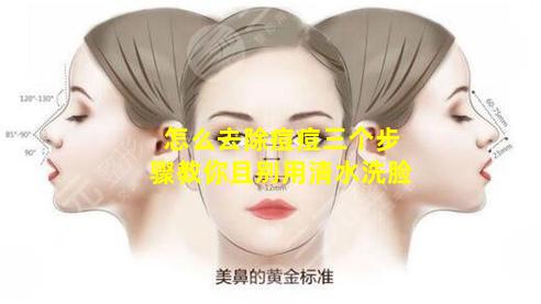 怎么去除痘痘三个步骤教你且别用清水洗脸
