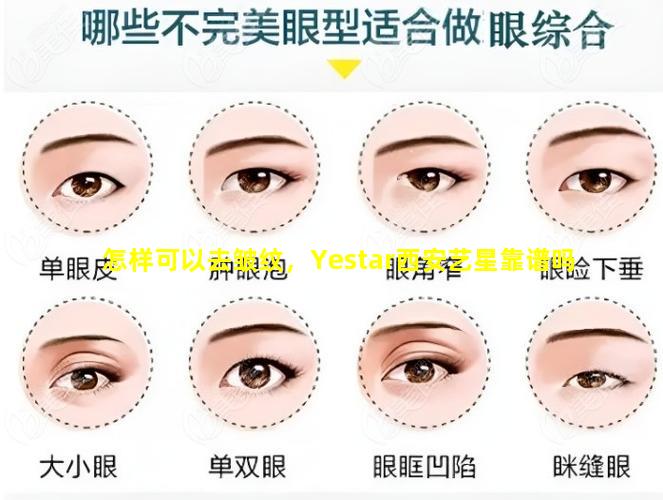 怎样可以去皱纹，Yestar西安艺星靠谱吗