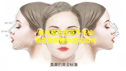 曙光整形拉皮手术价格及除皱前后变化如何
