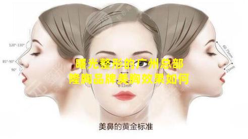 曙光整形的广州总部隆胸品牌美胸效果如何