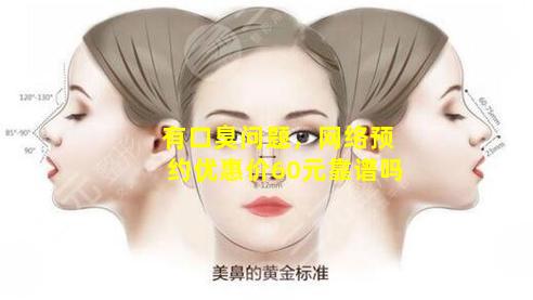 有口臭问题，网络预约优惠价60元靠谱吗