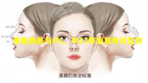 果酸换肤与IPL、M22等到底有何区别