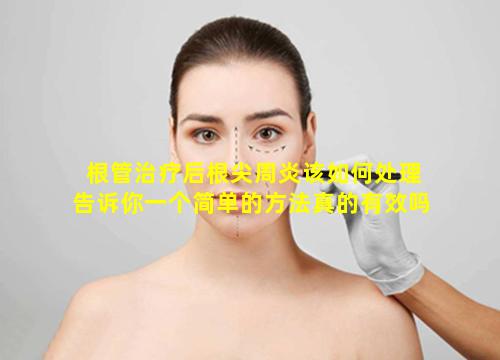 根管治疗后根尖周炎该如何处理告诉你一个简单的方法真的有效吗