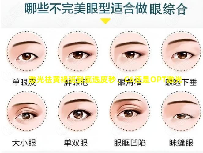 激光祛黄褐斑到底选皮秒、C6还是OPT激光