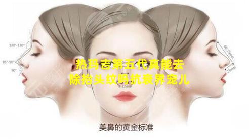 热玛吉第五代真能去除抬头纹吗抗衰界宠儿