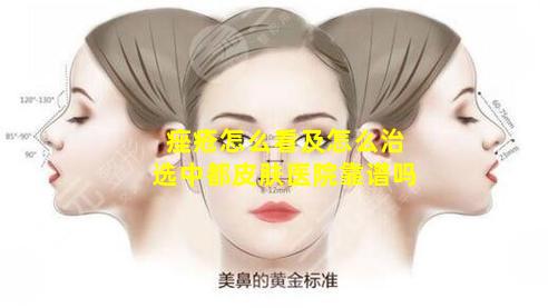 痤疮怎么看及怎么治选中都皮肤医院靠谱吗