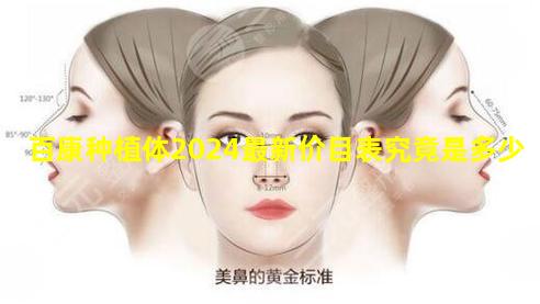 百康种植体2024最新价目表究竟是多少