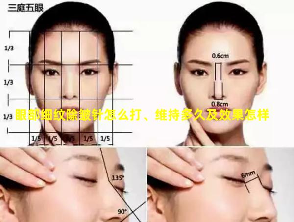 眼部细纹除皱针怎么打、维持多久及效果怎样