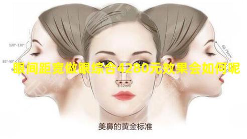眼间距宽做眼综合4280元效果会如何呢