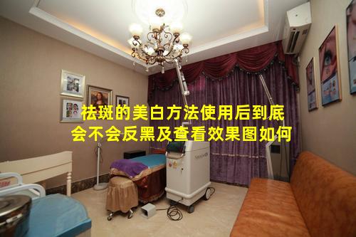 祛斑的美白方法使用后到底会不会反黑及查看效果图如何