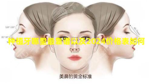 种植牙哪里最靠谱以及2024价格表如何
