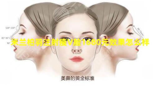 米兰柏羽注射瘦V脸1680元效果怎么样