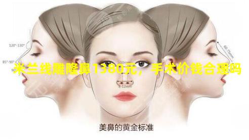 米兰线雕隆鼻1380元，手术价钱合理吗