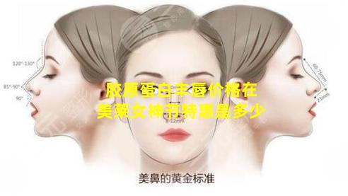 胶原蛋白丰唇价格在美莱女神节特惠是多少