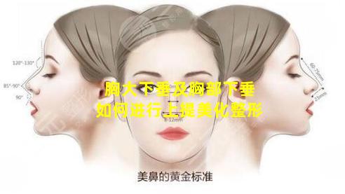 胸大下垂及胸部下垂如何进行上提美化整形