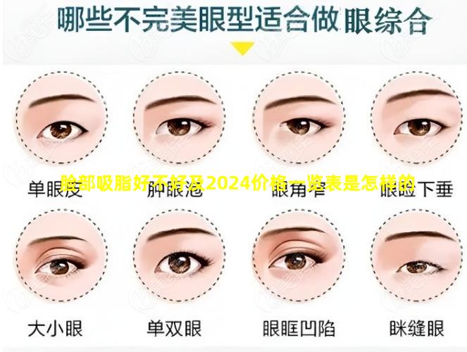 脸部吸脂好不好及2024价格一览表是怎样的